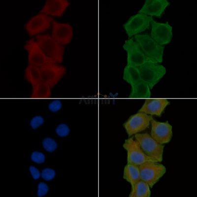 KCNA5 Antibody - DF4313 staining Hela cells(24h of starvation treatment) by IF/ICC.