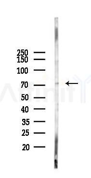 KCNQ4 Antibody - Western blot analysis of lysates from Hela cells(heat-shock 45min treatment), using KCNQ4 Antibody at 1/1000 dilution.