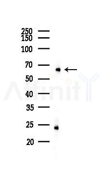 SLU7 Antibody - Western blot analysis of lysates from K562 cells(UV 30min treatment), using SLU7 Antibody at 1/1000 dilution.
