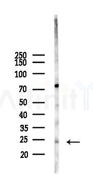 PPP1R14D Antibody - Western blot analysis of lysates from Hela cells(heat-shock 45min treatment), using PPP1R14D Antibody at 1/1000 dilution.