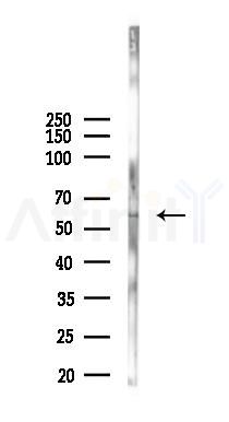 PPP1R16A Antibody - Western blot analysis of lysates from A2780 cells(starvation 24h treatment), using PPP1R16A Antibody at 1/1000 dilution.