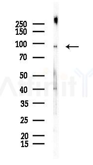 RASA3 Antibody - Western blot analysis of lysates from Mouse brain, using RASA3 Antibody at 1/1000 dilution.