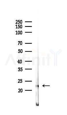 RAB18 Antibody - Western blot analysis of lysates from Rat brain, using RAB18 Antibody at 1/1000 dilution.