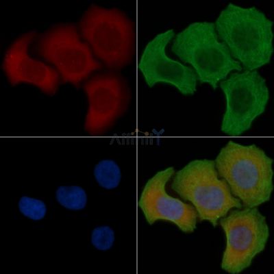 RAB6A Antibody - DF4407 staining Hela cells(30min of UV treatment) by IF/ICC.