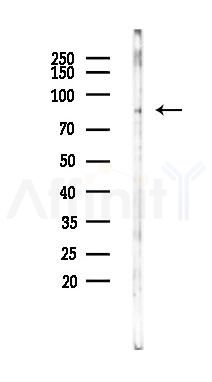 EWSR1 Antibody - Western blot analysis of lysates from B16F10-LUC cells(starvation 24h treatment), using EWSR1 Antibody at 1/1000 dilution.