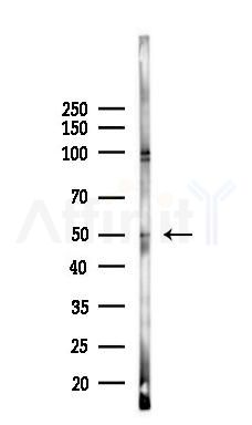 ULK3 Antibody - Western blot analysis of lysates from B16F10-LUC cells(heat-shock 45min treatment), using ULK3 Antibody at 1/1000 dilution.