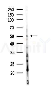 PPP4R2 Antibody - Western blot analysis of lysates from PC12 cells(LPS 4h treatment), using PPP4R2 Antibody at 1/1000 dilution.