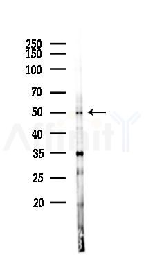 PPP4R2 Antibody - Western blot analysis of lysates from K562 cells(UV 30min treatment), using PPP4R2 Antibody at 1/1000 dilution.