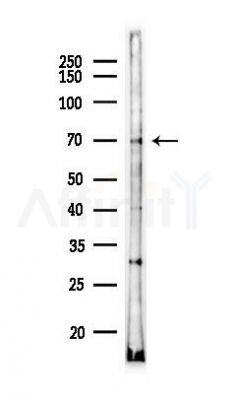 SLC6A3 Antibody - Western blot analysis of lysates from Rat brain, using SLC6A3 Antibody at 1/1000 dilution.