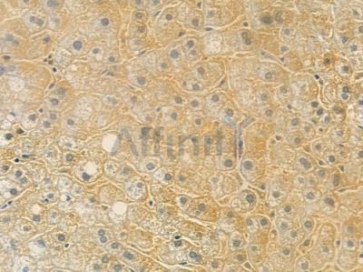THBD Antibody - DF4565 at 1/100 staining human normal liver tissue by IHC-P.