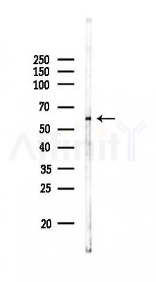 TIGD3 Antibody - Western blot analysis of lysates from RAW264.