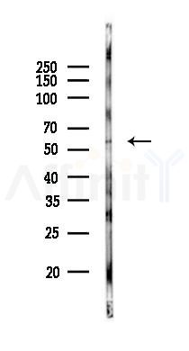 EIF2B4 Antibody - Western blot analysis of lysates from COLO205 cells(heat-shock 45min treatment), using EIF2B4 Antibody at 1/1000 dilution.
