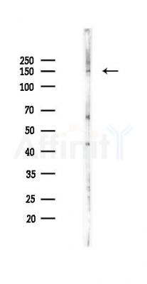 TIE1 Antibody - Western blot analysis of lysates from K562 cells(starvation 24h treatment), using TIE1 Antibody at 1/1000 dilution.