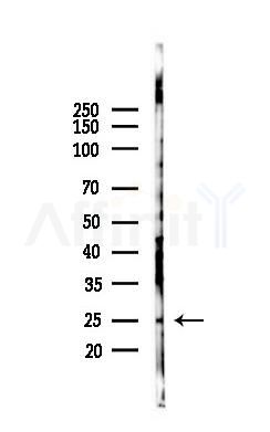 VTI1A Antibody - Western blot analysis of lysates from B16F10-LUC cells(heat-shock 45min treatment), using VTI1A Antibody at 1/1000 dilution.