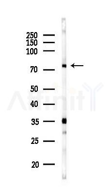 NSF Antibody - Western blot analysis of lysates from Rat brain, using NSF Antibody at 1/1000 dilution.