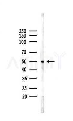 CA181 Antibody - Western blot analysis of lysates from B16F10-LUC cells(heat-shock 45min treatment), using CA181 Antibody at 1/1000 dilution.