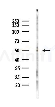 RAD23B Antibody - Western blot analysis of lysates from B16F10-LUC cells(starvation 24h treatment), using RAD23B Antibody at 1/1000 dilution.
