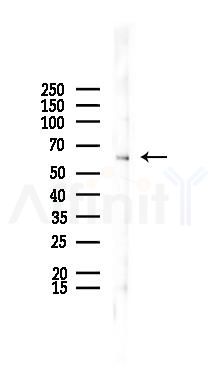 ZNF695 Antibody - Western blot analysis of lysates from Mouse lung, using ZNF695 Antibody at 1/1000 dilution.