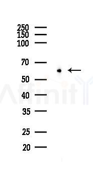 ZNF695 Antibody - Western blot analysis of lysates from B16F10-LUC cells(heat-shock 45min treatment), using ZNF695 Antibody at 1/1000 dilution.