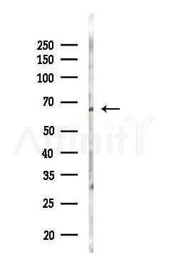 IKZF4 Antibody - Western blot analysis of lysates from Rat brain, using IKZF4 Antibody at 1/1000 dilution.