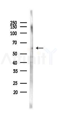 Cytochrome P450 11A1 Antibody - Western blot analysis of lysates from Hela cells(heat-shock 45min treatment), using Cytochrome P450 11A1 Antibody at 1/1000 dilution.