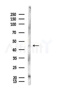 IL11RA Antibody - Western blot analysis of lysates from Rat testis, using IL11RA Antibody at 1/1000 dilution.