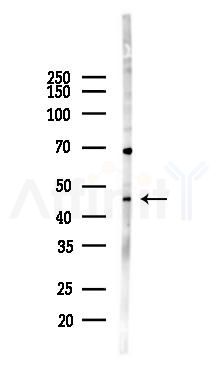 IL11RA Antibody - Western blot analysis of lysates from Hela cells(heat-shock 45min treatment), using IL11RA Antibody at 1/1000 dilution.