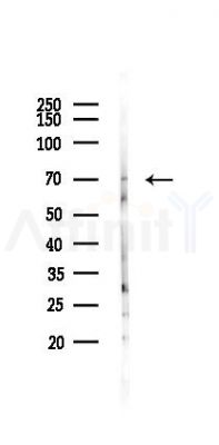 IL17RC Antibody - Western blot analysis of lysates from Mouse lung, using IL17RC Antibody at 1/1000 dilution.