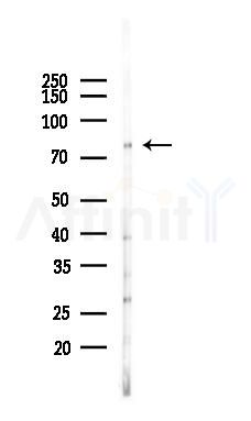 NFE2L3 Antibody - Western blot analysis of lysates from Hela cells(heat-shock 45min treatment), using NFE2L3 Antibody at 1/1000 dilution.