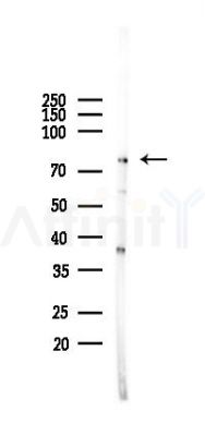 NFE2L3 Antibody - Western blot analysis of lysates from B16F10-LUC cells(heat-shock 45min treatment), using NFE2L3 Antibody at 1/1000 dilution.