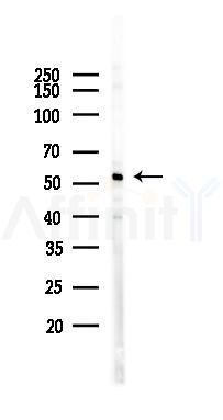 CYP1B1 Antibody - Western blot analysis of lysates from K562 cells(UV 30min treatment), using CYP1B1 Antibody at 1/1000 dilution.
