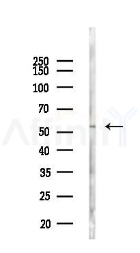 TBXAS1 Antibody - Western blot analysis of lysates from 293 cells(LPS 4h treatment), using TBXAS1 Antibody at 1/1000 dilution.