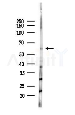 Cytochrome P450 4X1 Antibody - Western blot analysis of lysates from Hela cells(heat-shock 45min treatment), using Cytochrome P450 4X1 Antibody at 1/1000 dilution.