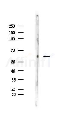 Cytochrome P450 2B6 Antibody - Western blot analysis of lysates from Rat liver, using Cytochrome P450 2B6 Antibody at 1/1000 dilution.