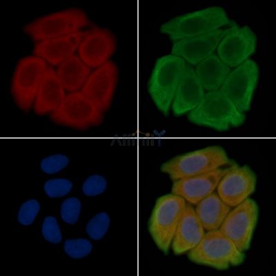 TRAF2 Antibody - DF4767 staining Hela cells(45min of heat-shock treatment) by IF/ICC.