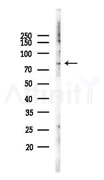 TBX3 Antibody - Western blot analysis of lysates from K562 cells(UV 30min treatment), using TBX3 Antibody at 1/1000 dilution.