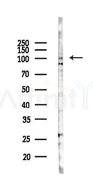 PKN1 Antibody - Western blot analysis of lysates from K562 cells(UV 30min treatment), using PKN1 Antibody at 1/1000 dilution.