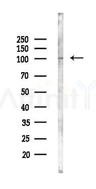 PKN1 Antibody - Western blot analysis of lysates from Hela cells(starvation 24h treatment), using PKN1 Antibody at 1/1000 dilution.