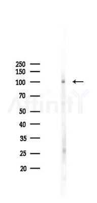 TLK1 Antibody - Western blot analysis of lysates from Mouse lung, using TLK1 Antibody at 1/1000 dilution.