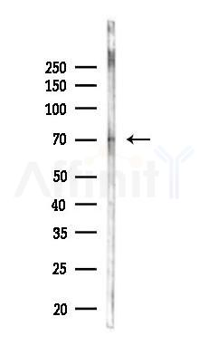 CAMKK2 Antibody - Western blot analysis of lysates from Rat brain, using CAMKK2 Antibody at 1/1000 dilution.