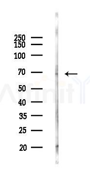 CAMKK2 Antibody - Western blot analysis of lysates from Rat brain, using CAMKK2 Antibody at 1/1000 dilution.