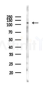 LAMP1 Antibody - Western blot analysis of lysates from K562 cells(UV 30min treatment), using LAMP1 Antibody at 1/1000 dilution.