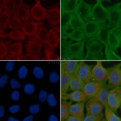 5HT5A receptor Antibody - DF4848 staining Hela cells(24h of starvation treatment) by IF/ICC.