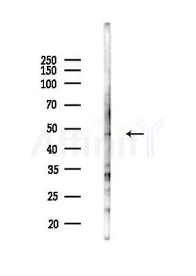 ADRB2 Antibody - Western blot analysis of lysates from 293 cells(UV 30min treatment), using ADRB2 Antibody at 1/1000 dilution.