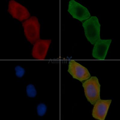 CXCR3 Antibody - DF4858 staining Hela cells(30min of UV treatment) by IF/ICC.