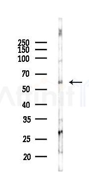 CXCR7 Antibody - Western blot analysis of lysates from K562 cells(UV 30min treatment), using CXCR7 Antibody at 1/1000 dilution.