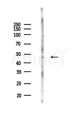 CRHR2 Antibody - Western blot analysis of lysates from 293 cells(UV 30min treatment), using CRHR2 Antibody at 1/1000 dilution.