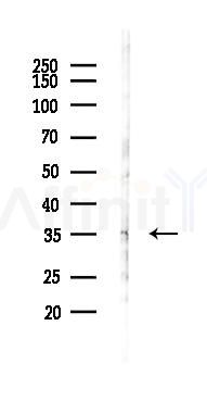 GPR18 Antibody - Western blot analysis of lysates from HUVEC cells(LPS 4h treatment), using GPR18 Antibody at 1/1000 dilution.