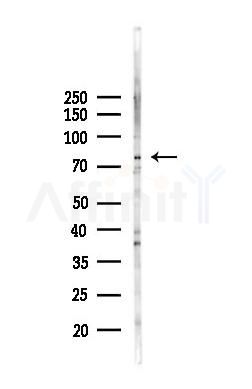 PTHR1 Antibody - Western blot analysis of lysates from 293 cells(LPS 4h treatment), using PTHR1 Antibody at 1/1000 dilution.