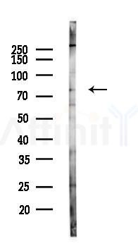 FZD6 Antibody - Western blot analysis of lysates from HUVEC cells(LPS 4h treatment), using FZD6 Antibody at 1/1000 dilution.